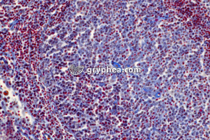 Ganglion lymphatique x100 - gryphea.com